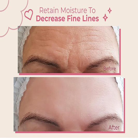 4 PACK Forehead Wrinkle Patches